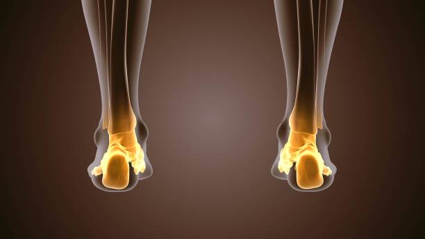 ACl surgery