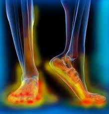 Neuropathy Pain
