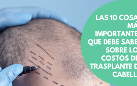 Las-10-cosas-mas-importantes-que-debe-saber-sobre-los-costos-del-trasplante-de-cabello