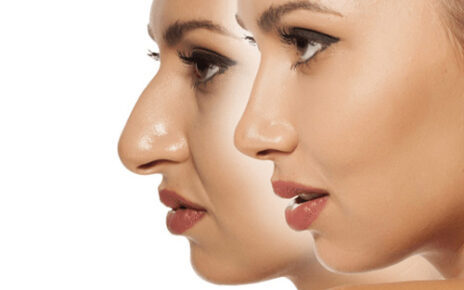 Rhinoplasty in Abu Dhabi
