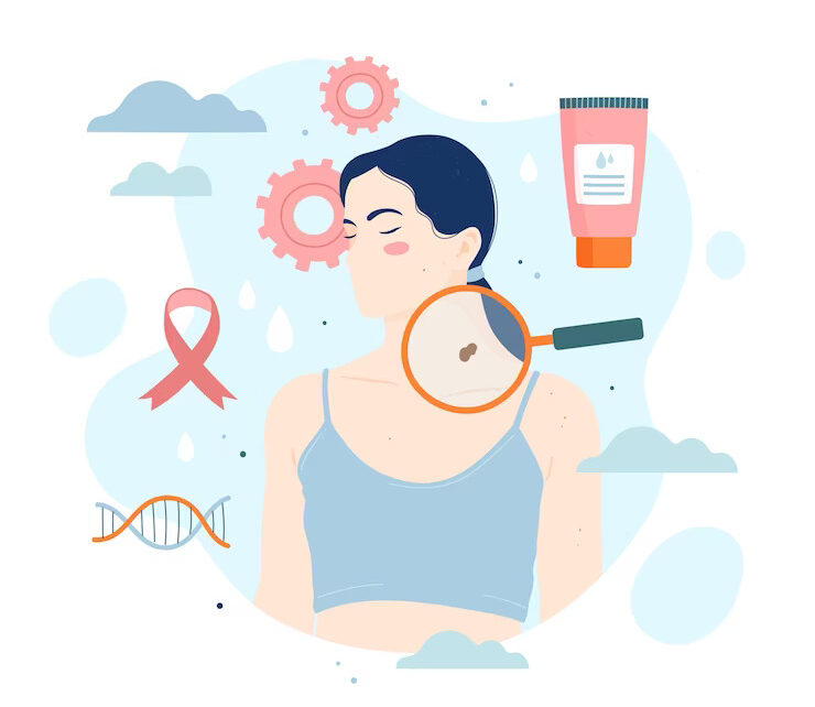 Effective Strategies to Prevent Skin Cancer