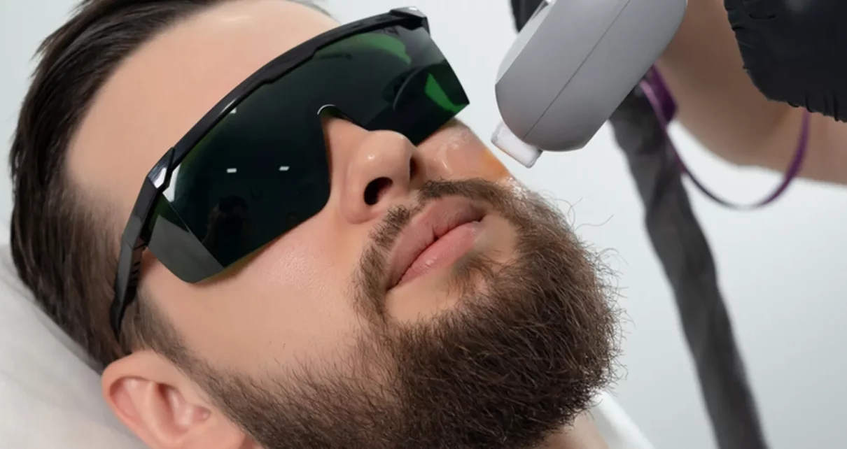 Beard Laser Hair Removal in Abu Dhabi 