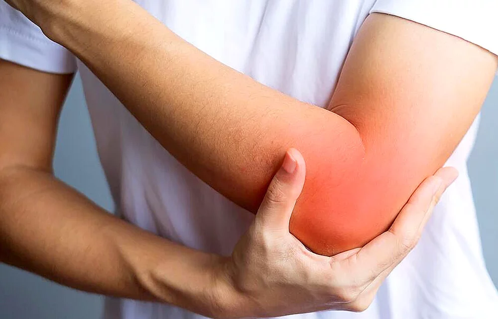 pain o soma 500mg-elbow pain