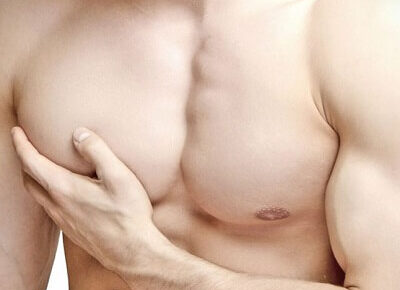 Gynecomastia Surgery in Islamabad