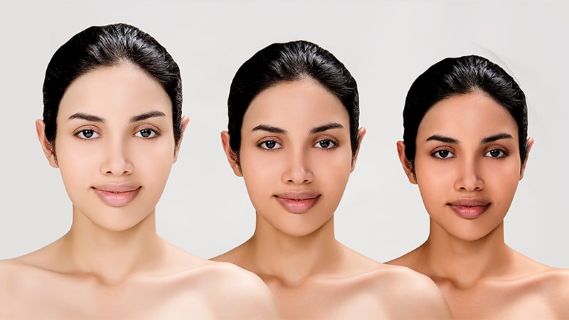 Skin Brightening Treatment