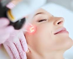Laser Treatments in Riyadh