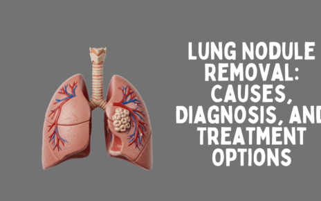 Lung Nodule Removal: Causes, Diagnosis, and Treatment Options