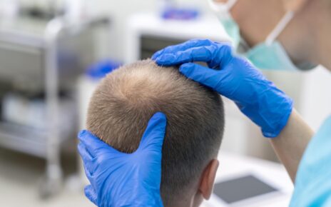 Hair transplant in Riyadh