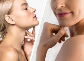 Double Chin Liposuction in Islamabad 1