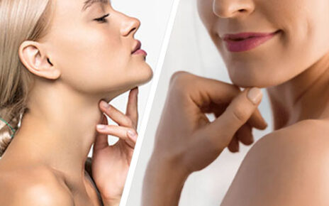 Double Chin Liposuction in Islamabad 1