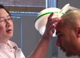 Hair transplant in Riyadh