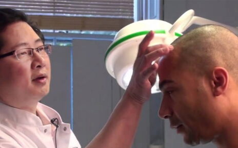 Hair transplant in Riyadh