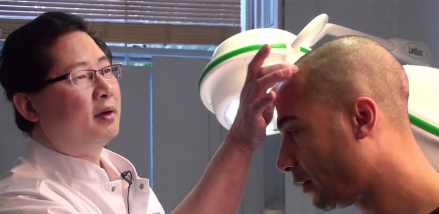 Hair transplant in Riyadh