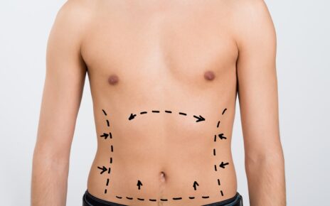 liposuction in Islamabad